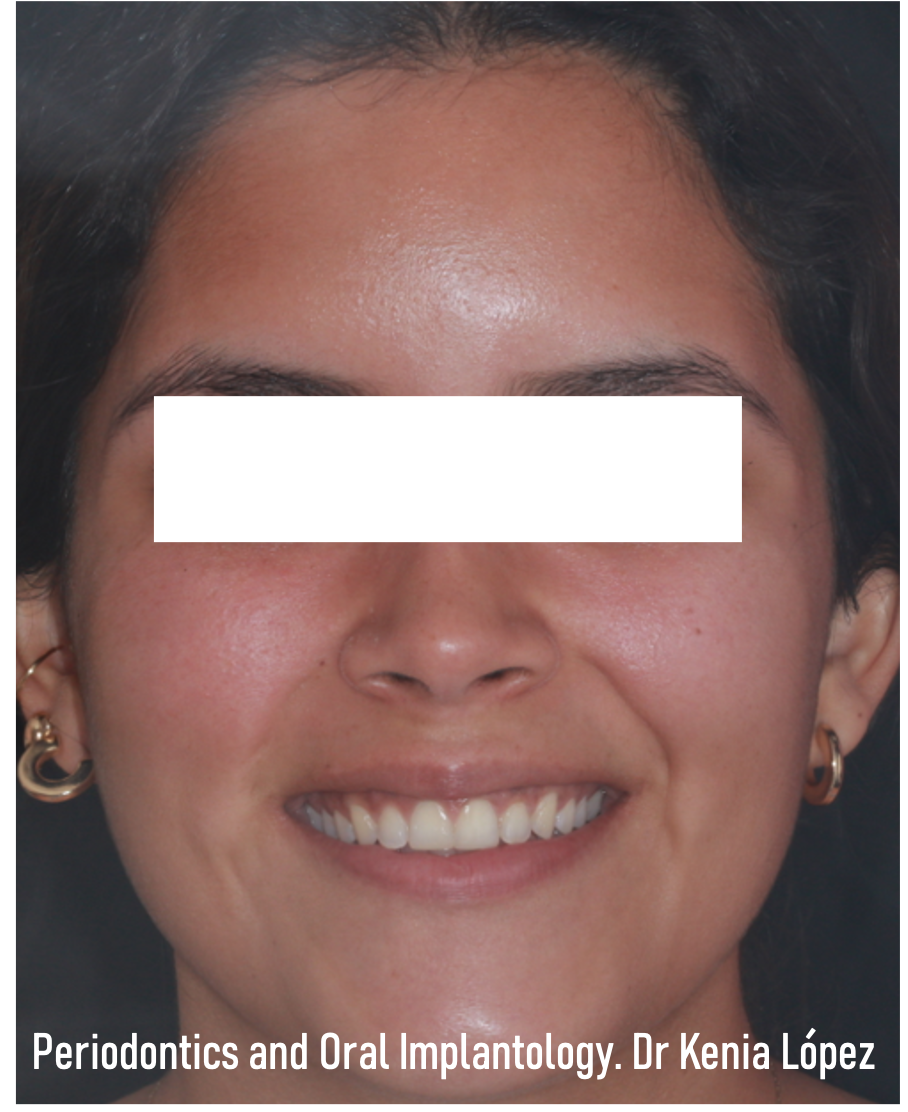 ESTÉTICA DENTAL