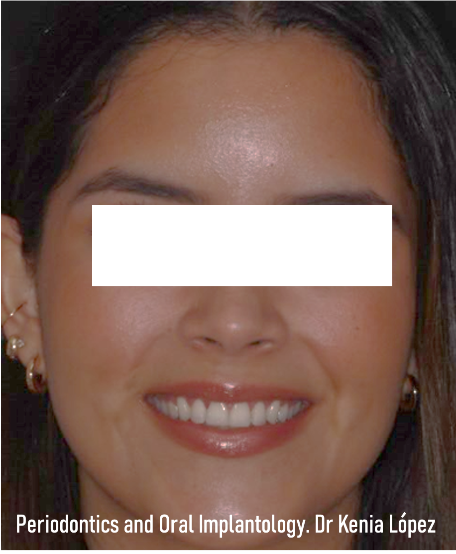 ESTÉTICA DENTAL